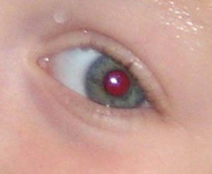 red pupil